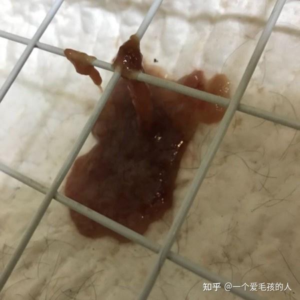 小伙腹瀉兩周，查出感染鬼臉蟲