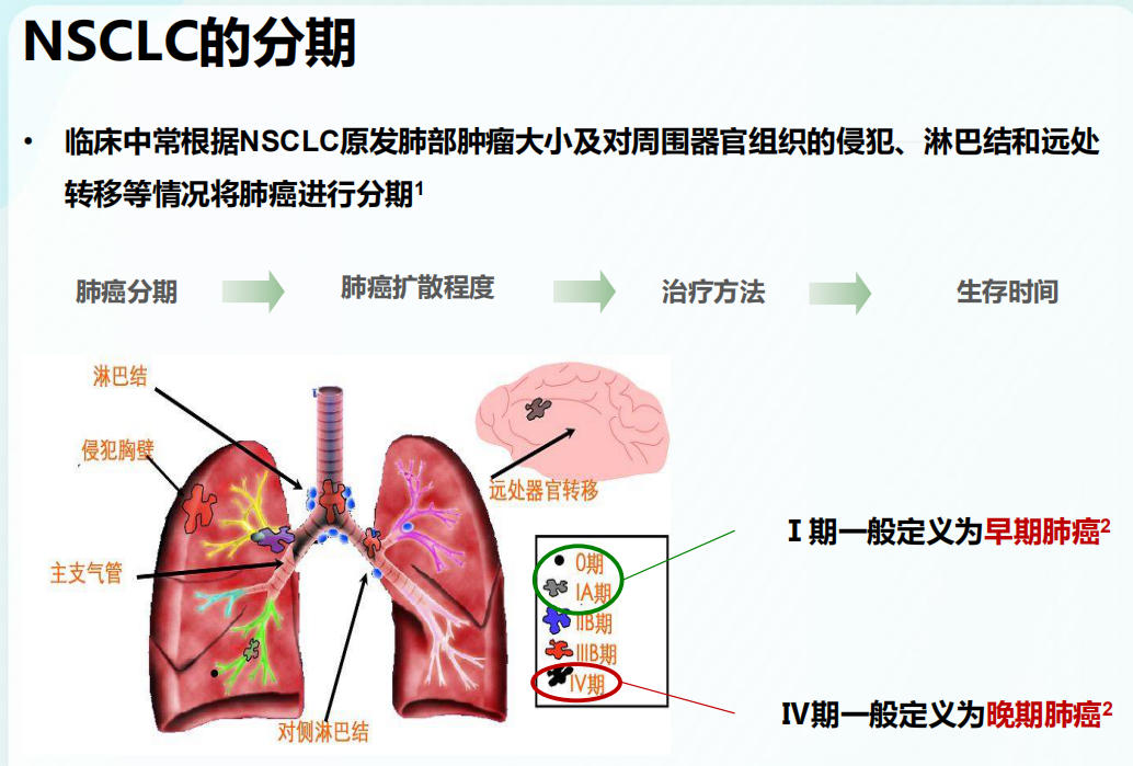 肺癌形成過程與相關(guān)因素解析揭秘