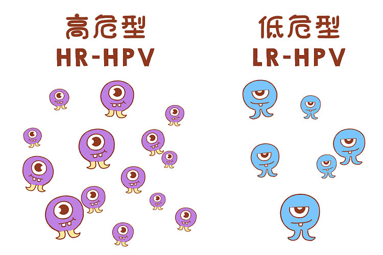 從HPV感染到宮頸癌只有5步