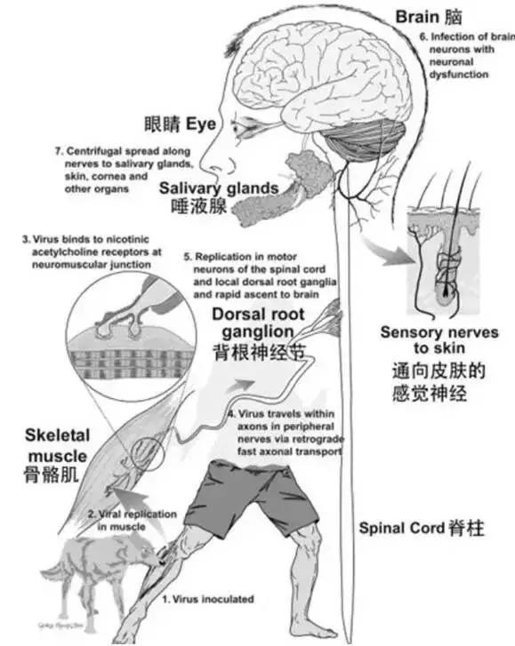 狂犬病再次奪走一條生命，男子被狗咬傷4個月后發(fā)作致死