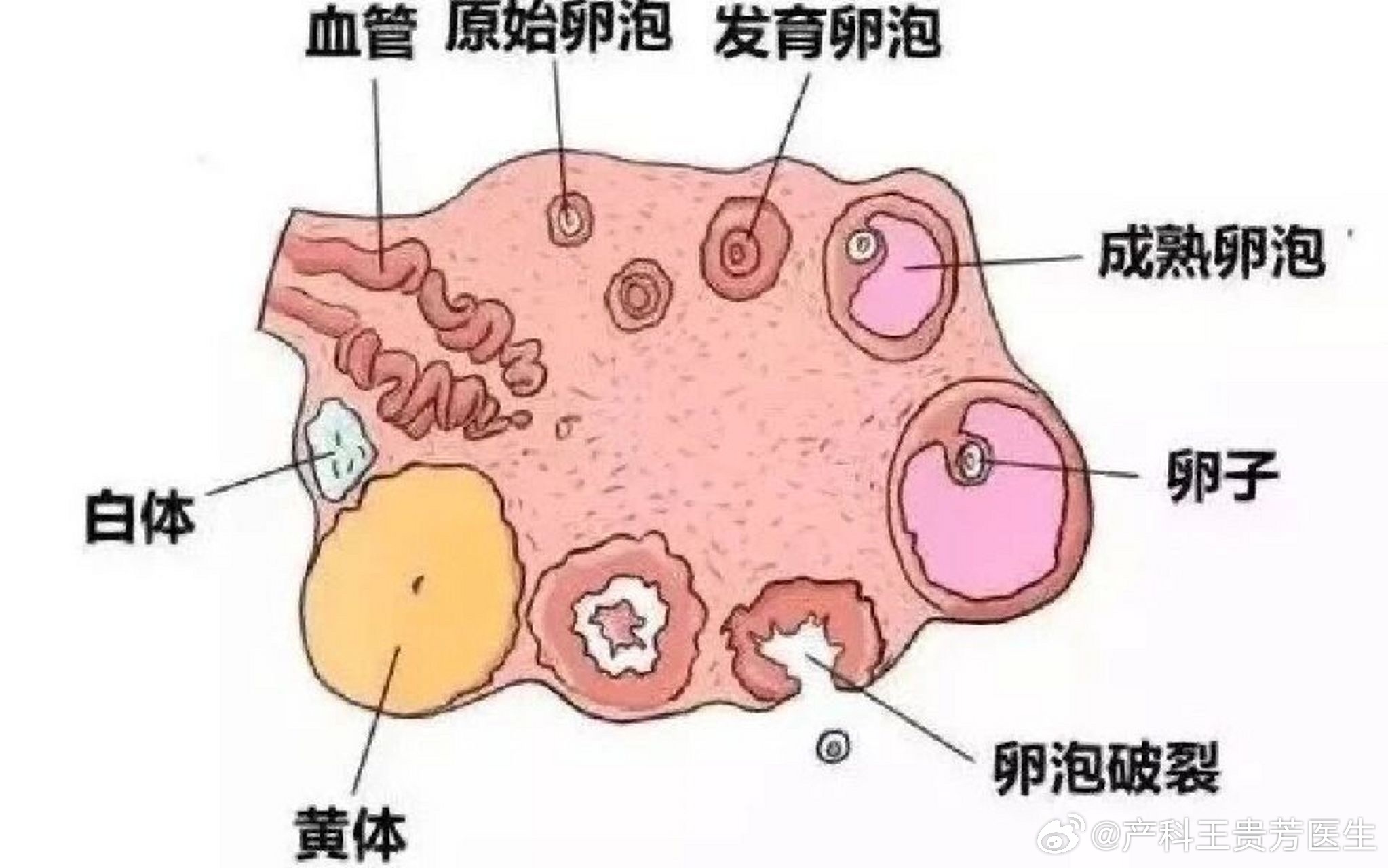 夫妻玩鬧時妻子黃體破裂，了解這種婦科急癥，妻子黃體破裂，夫妻玩鬧時的意外，婦科急癥，夫妻玩鬧時妻子黃體破裂，夫妻玩鬧時，妻子遭遇黃體破裂，黃體破裂，夫妻玩鬧時的風(fēng)險